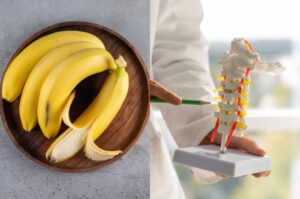 Penderita Osteoporosis Wajib Tahu! Ini Daftar Makanan yang Bisa Menguatkan Tulang